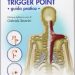 Trigger point